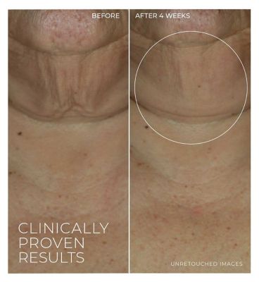 RoC Derm Correxion Retinol Firming Serum Stick to Lift, Tighten & Smooth Fine Lines 30g (6)