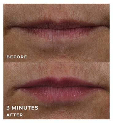 RoC Derm Correxion Lip Volumizer with Hyaluronic Acid 10ml (6)