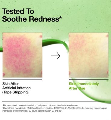 Anua Azelaic Acid 10 Hyaluron Redness Soothing Serum 30ml (12)