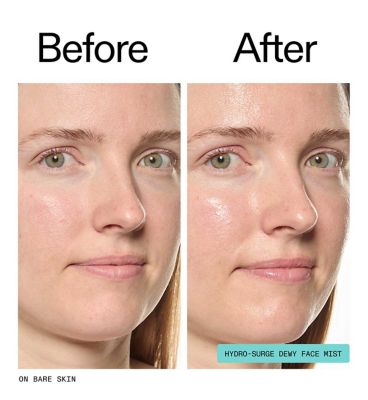 The Inkey List Hydro-Surge Dewy Face Mist 75ml (7)