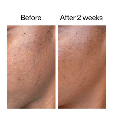 The INKEY list 360 Skin Clearing Serum 30ml (7)