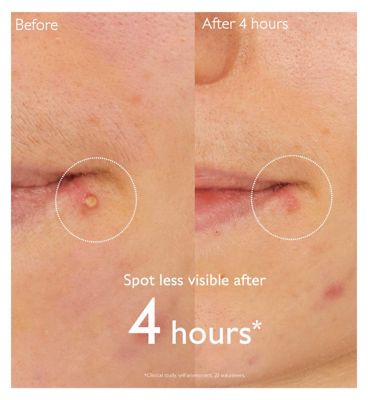 Caudalie Vinopure Salicylic Spot Solution 15ml (5)