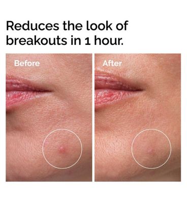 The Ordinary Sulfur 10% Powder-to-Cream Concentrate for Blemishes 5g (3)