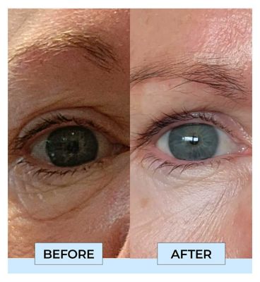 Boost Lab Eye Reset Serum 30ml (4)