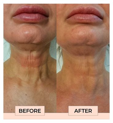 Boost Lab Neck Firming Serum 30ml (6)