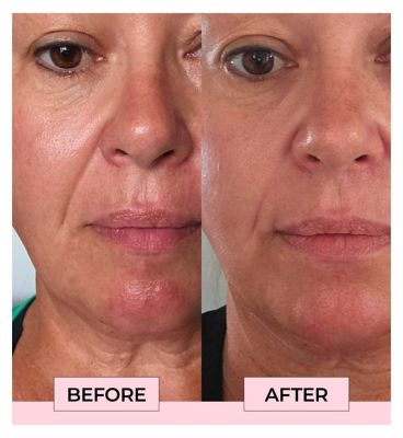 Boost Lab Anti Ageing Serum 30ml (5)