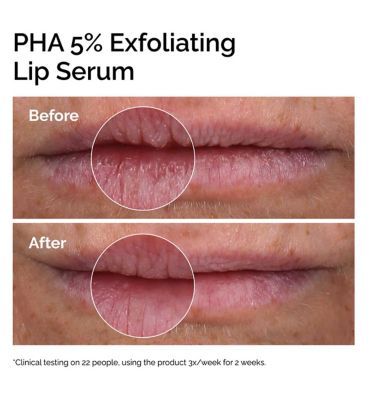 PHA 5% Exfoliating Lip Serum (11)