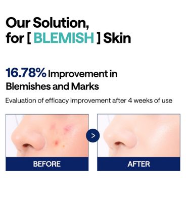 Mediheal Madecassoside Blemish Pad (100 Pads) (5)