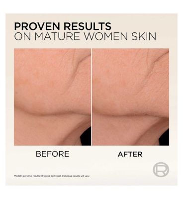 L'Oreal Paris Age Perfect Micro-Collagen Firming Serum - Micro-Collagen Peptides + Niacinamide, 30ml (5)