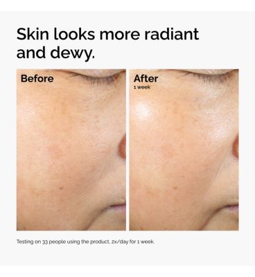 The Ordinary Rice Lipids + Ectoin Microemulsion For Dry And Dehydrated Skin 120ml (3)